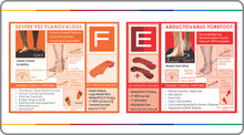 Load image into Gallery viewer, The Science Behind Forefoot Varus: E & F Foot Types - Instructor: Roberta Nole, MA, PT, C.Ped (FOR PRACTITIONERS)
