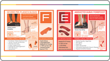 Load image into Gallery viewer, The Science Behind Forefoot Varus: E &amp; F Foot Types - Instructor: Roberta Nole, MA, PT, C.Ped (FOR PRACTITIONERS)
